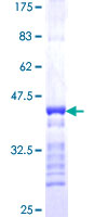 ab165649 on a 12.5% SDS-PAGE stained with Coomassie Blue.