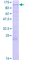 ab162311 on a 12.5% SDS-PAGE stained with Coomassie Blue.