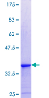ab162312 on a 12.5% SDS-PAGE stained with Coomassie Blue.