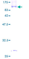 ab162548 on a 12.5% SDS-PAGE stained with Coomassie Blue.