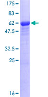 ab153537 on a 12.5% SDS-PAGE stained with Coomassie Blue.