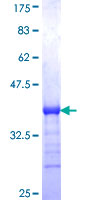ab153538 on a 12.5% SDS-PAGE stained with Coomassie Blue.