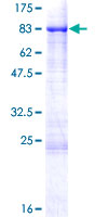 ab162689 on a 12.5% SDS-PAGE stained with Coomassie Blue.