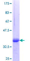 ab162690 on a 12.5% SDS-PAGE stained with Coomassie Blue.