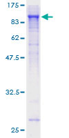 ab166484 on a 12.5% SDS-PAGE stained with Coomassie Blue.