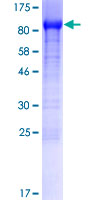 ab164118 on a 12.5% SDS-PAGE stained with Coomassie Blue.