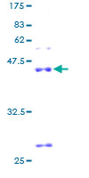 ab162469 on a 12.5% SDS-PAGE stained with Coomassie Blue.