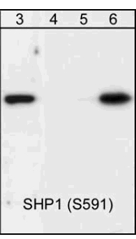 All lanes : Anti-SHP1 (phospho S591) antibody ( ab41436 ) Lane 3 : human Jurkat cells treated with pervanadate (1 mM) for 30 min Lane 4 : human Jurkat cells treated with pervanadate (1 mM ( for 30 min) and exposed to lambda phosphatase Lane 5 : human Jurkat cells treated with pervanadate (1 mM) for 30 min with phospho-SHP1 (Ser-591) peptide Lane 6 : human Jurkat cells treated with pervanadate (1 mM) for 30 min with non-specific phospho-serine peptide