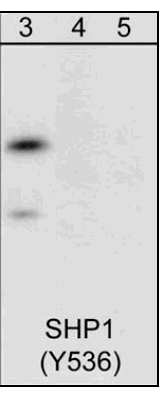 All lanes : Anti-SHP1 (phospho Y536) antibody ( ab41437 ) Lane 3 : human Jurkat cells treated with pervanadate (1 mM) for 30 min. Lane 4 : human Jurkat cells treated with pervanadate (1 mM)for 30 min and exposed to alkaline phosphatase Lane 5 : human Jurkat cells treated with pervanadate (1 mM) for 30 min. with phospho-SHP1 (Tyr-536) peptide (ab42773)