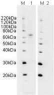 All lanes : Anti-SHP2 antibody ( ab10555 ) at 2 µg/ml Lane 1 : Jurkat lysate Lane 2 : Jurkat with Human SHP2 peptide (ab14800) at 1 µg/ml Lysates/proteins at 20 µg per lane. Performed under reducing conditions. Predicted band size : 68 kDa Observed band size : 68 kDa M=Marker