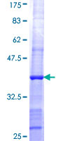 ab166079 on a 12.5% SDS-PAGE stained with Coomassie Blue.