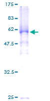 ab153608 on a 12.5% SDS-PAGE stained with Coomassie Blue.