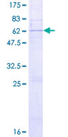 ab166064 on a 12.5% SDS-PAGE stained with Coomassie Blue.