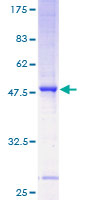 ab159906 on a 12.5% SDS-PAGE stained with Coomassie Blue.