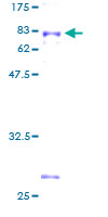 ab162060 on a 12.5% SDS-PAGE stained with Coomassie Blue.