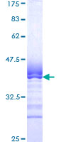 ab162061 on a 12.5% SDS-PAGE stained with Coomassie Blue.