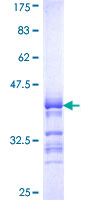 ab158056 on a 12.5% SDS-PAGE stained with Coomassie Blue.