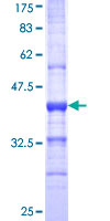 ab162108 on a 12.5% SDS-PAGE stained with Coomassie Blue.