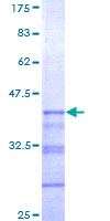 ab164787 on a 12.5% SDS-PAGE stained with Coomassie Blue.