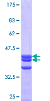 ab164788 on a 12.5% SDS-PAGE stained with Coomassie Blue.