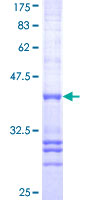 ab159511 on a 12.5% SDS-PAGE stained with Coomassie Blue.