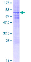 ab161600 on a 12.5% SDS-PAGE stained with Coomassie Blue.