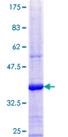 ab161601 on a 12.5% SDS-PAGE stained with Coomassie Blue.