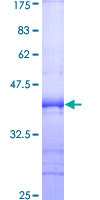 ab159512 on a 12.5% SDS-PAGE stained with Coomassie Blue.