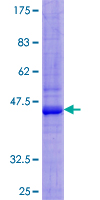 ab160947 on a 12.5% SDS-PAGE stained with Coomassie Blue.