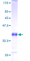 ab161050 on a 12.5% SDS-PAGE stained with Coomassie Blue.
