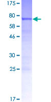 ab164548 on a 12.5% SDS-PAGE stained with Coomassie Blue.