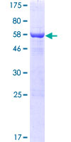 ab163604 on a 12.5% SDS-PAGE stained with Coomassie Blue.