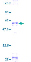 ab163660 on a 12.5% SDS-PAGE stained with Coomassie Blue.