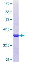 ab163661 on a 12.5% SDS-PAGE stained with Coomassie Blue.