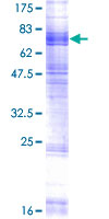 ab162497 on a 12.5% SDS-PAGE stained with Coomassie Blue.