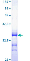 ab161045 on a 12.5% SDS-PAGE stained with Coomassie Blue.