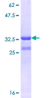 ab159516 on a 12.5% SDS-PAGE stained with Coomassie Blue.