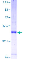 ab159518 on a 12.5% SDS-PAGE stained with Coomassie Blue.