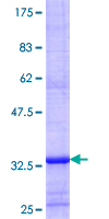 ab163260 on a 12.5% SDS-PAGE stained with Coomassie Blue.