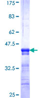 ab159539 on a 12.5% SDS-PAGE stained with Coomassie Blue.