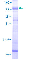 ab161177 on a 12.5% SDS-PAGE stained with Coomassie Blue.
