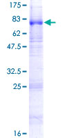 ab160461 on a 12.5% SDS-PAGE stained with Coomassie Blue.