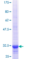 ab160462 on a 12.5% SDS-PAGE stained with Coomassie Blue.