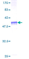ab160742 on a 12.5% SDS-PAGE stained with Coomassie Blue.