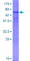ab160741 on a 12.5% SDS-PAGE stained with Coomassie Blue.