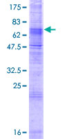 ab166145 on a 12.5% SDS-PAGE stained with Coomassie Blue.