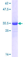 ab160108 on a 12.5% SDS-PAGE stained with Coomassie Blue.