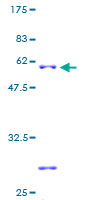 ab161010 on a 12.5% SDS-PAGE stained with Coomassie Blue.
