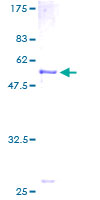 ab158016 on a 12.5% SDS-PAGE stained with Coomassie Blue.