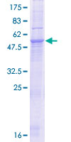 ab164790 on a 12.5% SDS-PAGE stained with Coomassie Blue.